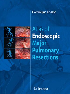 cover image of Atlas of endoscopic major pulmonary resections
